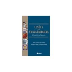 Imagem de Lesões das Valvas Cardíacas - Do Diagnóstico ao Tratamento - Meneghelo, Zilda Machado; Ramos, Auristela Isabel De Oliveira - 9788573799026
