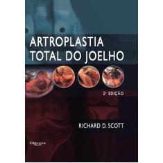 Imagem de ARTROPLASTIA TOTAL DO JOELHO - Scott, Richard D - 9788580531039