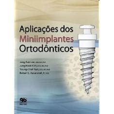 Imagem de Aplicações dos Miniimplantes Ortodônticos - Lee, Jong Suk - 9788587425904