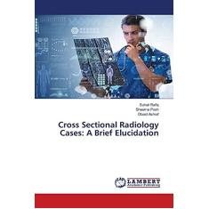 Imagem de Cross Sectional Radiology Cases: A Brief Elucidation