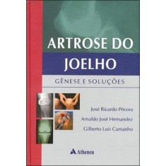 Imagem de Artrose do Joelho - Gênese e Soluções - Pecora, Jose Ricardo - 9788538801313