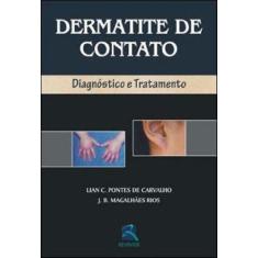 Imagem de Dermatite De Contato. Diagnostico E Tratamento - Capa Dura - 9788573097900