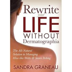 Imagem de Rewrite Your Life Without Dermatographia: The All-Natural Solution to Managing Hive-Like Welts and Severe Itching