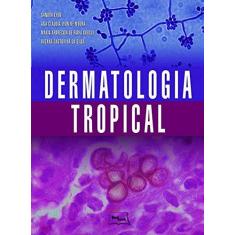 Imagem de Dermatologia Tropical - Sandra Lyon - 9788583690139