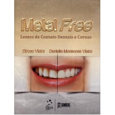 Imagem de Metal Free - Lentes de Contato e Coroas - Vieira, Dirceu; Monsores Vieira, Danielle - 9788541201582