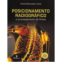 Imagem de Posicionamento Radiográfico e Processamento de Filmes - Denis Honorato Costa - 9788581160771
