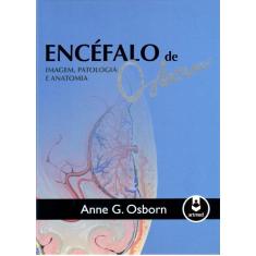 Imagem de Encéfalo de Osborn. Imagem, Patologia e Anatomia - Capa Dura - 9788582710807