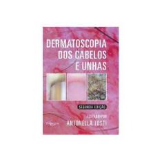 Imagem de Dermatoscopia Dos Cabelos E Unhas - 2ª Ed. 2016 - Tosti, Antonella; - 9788580531336