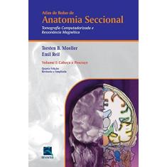 Imagem de Anatomia Seccional Tomografia Computadorizada e Ressonância Magnética: Cabeça e Pescoço - Vol.1 - Torsten B. Moeller - 9788537206324