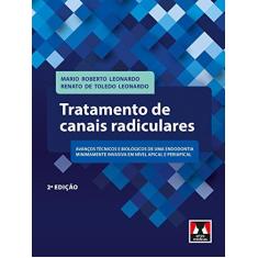 Imagem de Tratamento de Canais Radiculares - Mario R. Leonardo - 9788536702643