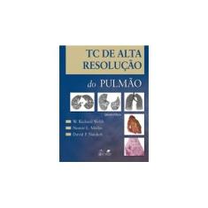 Imagem de Tc de Alta Resolução do Pulmão - 4ª Ed. 2010 - Webb, W. Richard; Naidich, David P.; Müller, Nestor L. - 9788527716383