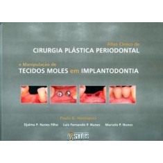 Imagem de Atlas Clínico de Cirurgia Plástica Periodontal - Paulo, G. Henriques - 9788572886468