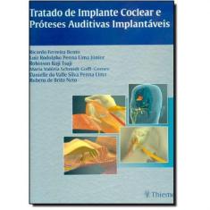 Imagem de Tratado De Implante Coclear E Proteses Auditivas Implantaveis - Ricardo Ferreira Bento - 9788567661025