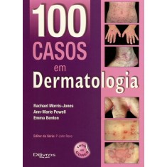 Imagem de 100 Casos em Dermatologia - Morris-jones, Rachael - 9788580530438