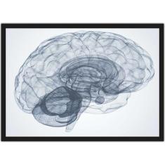 Imagem de Quadro Decorativo Psicologia Cérebro Medicina Decorações Com Moldura -