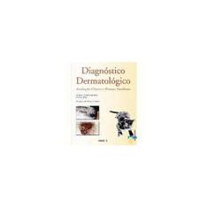 Imagem de Diagnóstico Dermatológico - Avaliação Clínica e Exames Imediatos - Carlotti, Didier- Noël; Pin, Didier - 9788572415354