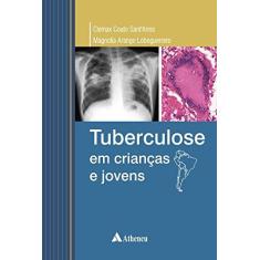 Imagem de Tuberculose em Crianças e Jovens - Magnolia Arango Loboguerrero, Clemax Couto Sant'anna - 9788538805724