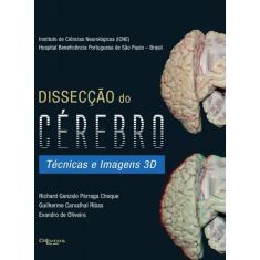 Imagem de DISSECCAO DO CEREBRO - TECNICAS E IMAGENS 3D - Choque, Richard Gonzalo Parraga/ Ribas, Guilherme Carvalhal/ Oliveira, Evandro De - 9788580531084