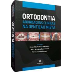 Ortodontia - Abordagens Clinicas Na Denticao Mista