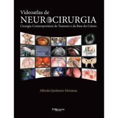 Livro: videoatlas de neurocirurgia