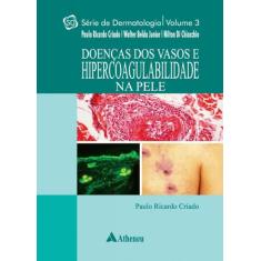 Livro - Doenças dos Vasos e Hipercoagulabilidade na pele