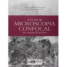Atlas de Microscopia Confocal na Dermatologia: Volume 1