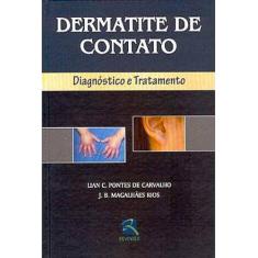 Livro - Dermatite de Contato