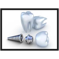 Quadro Decorativo Profissão Dentista Odontologia Implante Dentes Consu