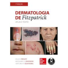Livro - Dermatologia de Fitzpatrick