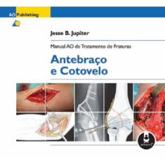 Manual Ao De Tratamento De Fraturas: Antebraco E Cotovelo