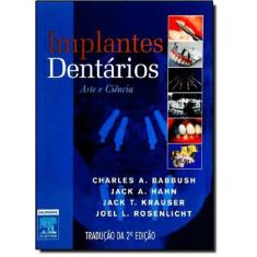 Implantes Dentários: Arte e Ciência - Implantes Dentarios: Arte E Cien