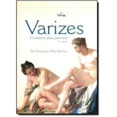 Varizes - Conhecer Para Prevenir