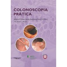 Colonoscopia Pratica