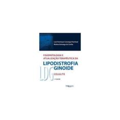 Fisiopatologia E Atualização Terapêutica Da Lipodistrofia Ginoide - LD