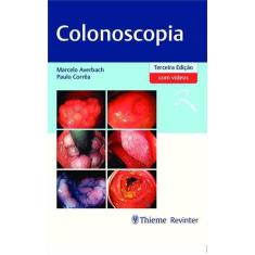 Colonoscopia