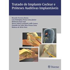 Tratado de Implante Coclear e Próteses Auditivas Implantáveis