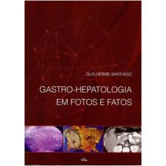 Gastro-Hepatologia Em Fotos E Fatos - Folium