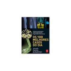 Livro - Os 100 melhores casos do dia