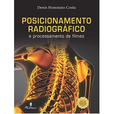 Posicionamento Radiográfico e Processamento de Filmes