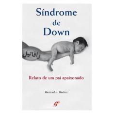 Síndrome De Down