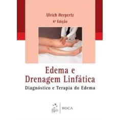 Livro - Edema E Drenagem Linfática - Diagnóstico E Terapia Do Edema