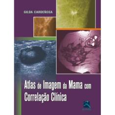 Atlas De Imagem Da Mama Com Correlação Clínica