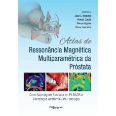 Atlas De Ressonancia Magnetica Multiparametrica Da Prostata