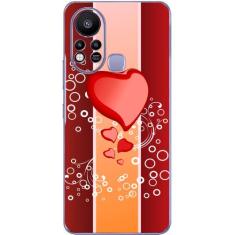 Capa Adesivo Skin372 Verso Para Infinix Hot 11s (2021) - KawaSkin