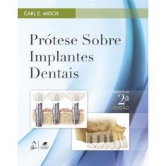 Livro - Prótese sobre Implantes Dentais