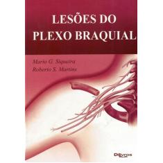Lesoes do plexo braquial - Di Livros Editora Ltda