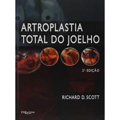 Artroplastia Total do Joelho