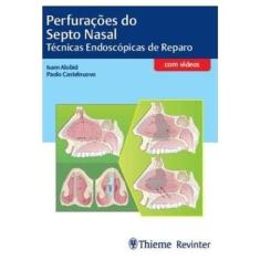 Perfuracoes Do Septo Nasal  Tecnicas Endoscopicas De Reparo
