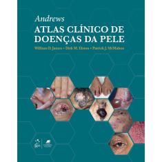 Andrew Atlas Clínico De Doenças Da Pele - 1ª Ed.