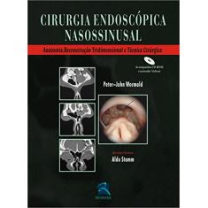 Cirurgia Endoscopica Nasossinusal: Anatomia, Reconstrução Tridimensional e Técnica Cirúrgica